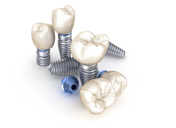 Dental Implant Restoration Winston-Salem, NC