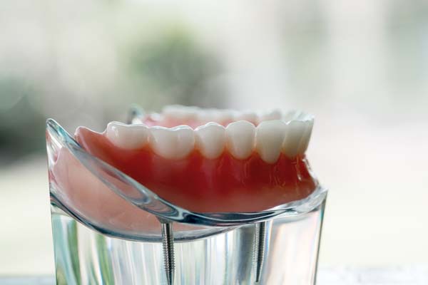 Tips For Keeping Dentures In Good Shape
