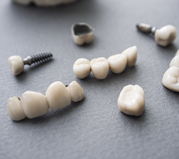 Winston-Salem The Difference Between Dental Implants and Mini Dental Implants